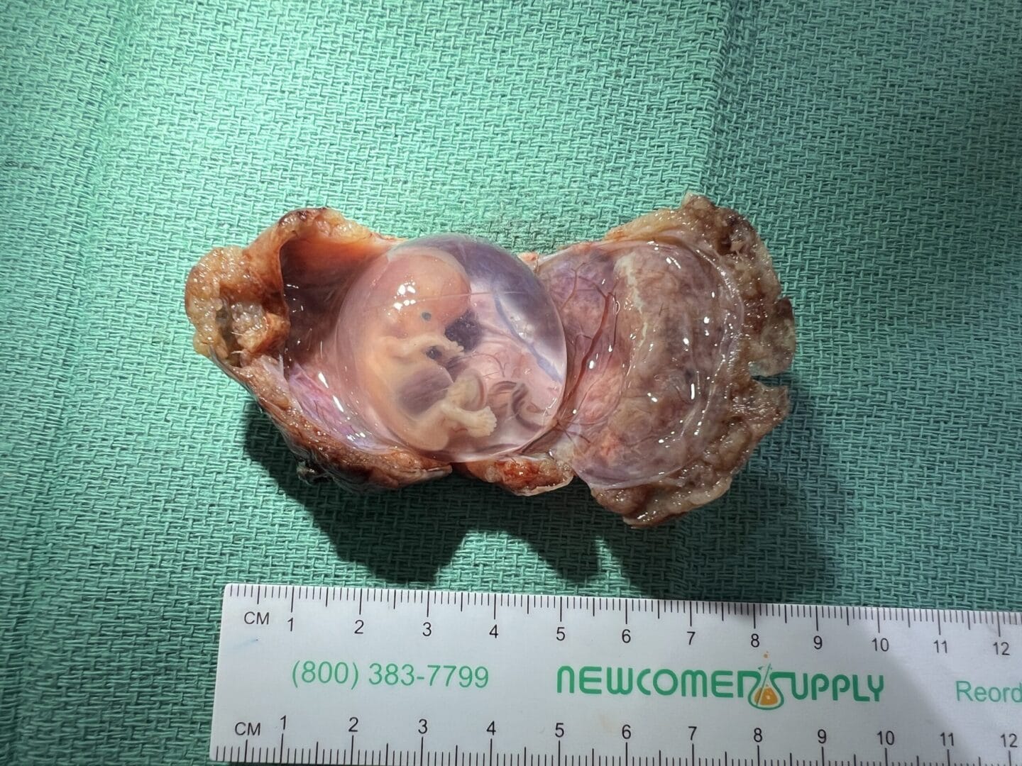 The Formalin Fixation
