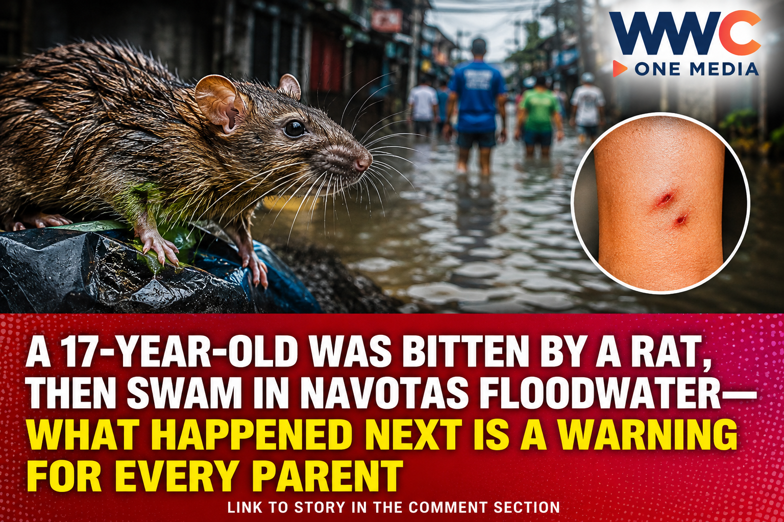 A 17-Year-Old Was Bitten by a Rat, Then Swam in Navotas Floodwater—What Happened Next Is a Warning for Every Parent