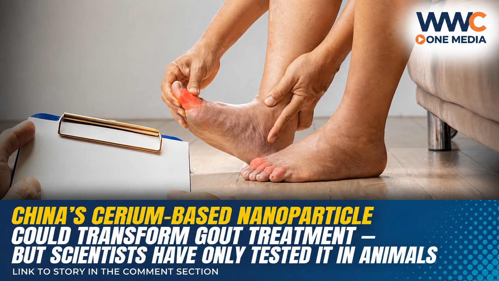 China’s Cerium-Based Nanoparticle Could Transform Gout Treatment — But Scientists Have Only Tested It in Animals
