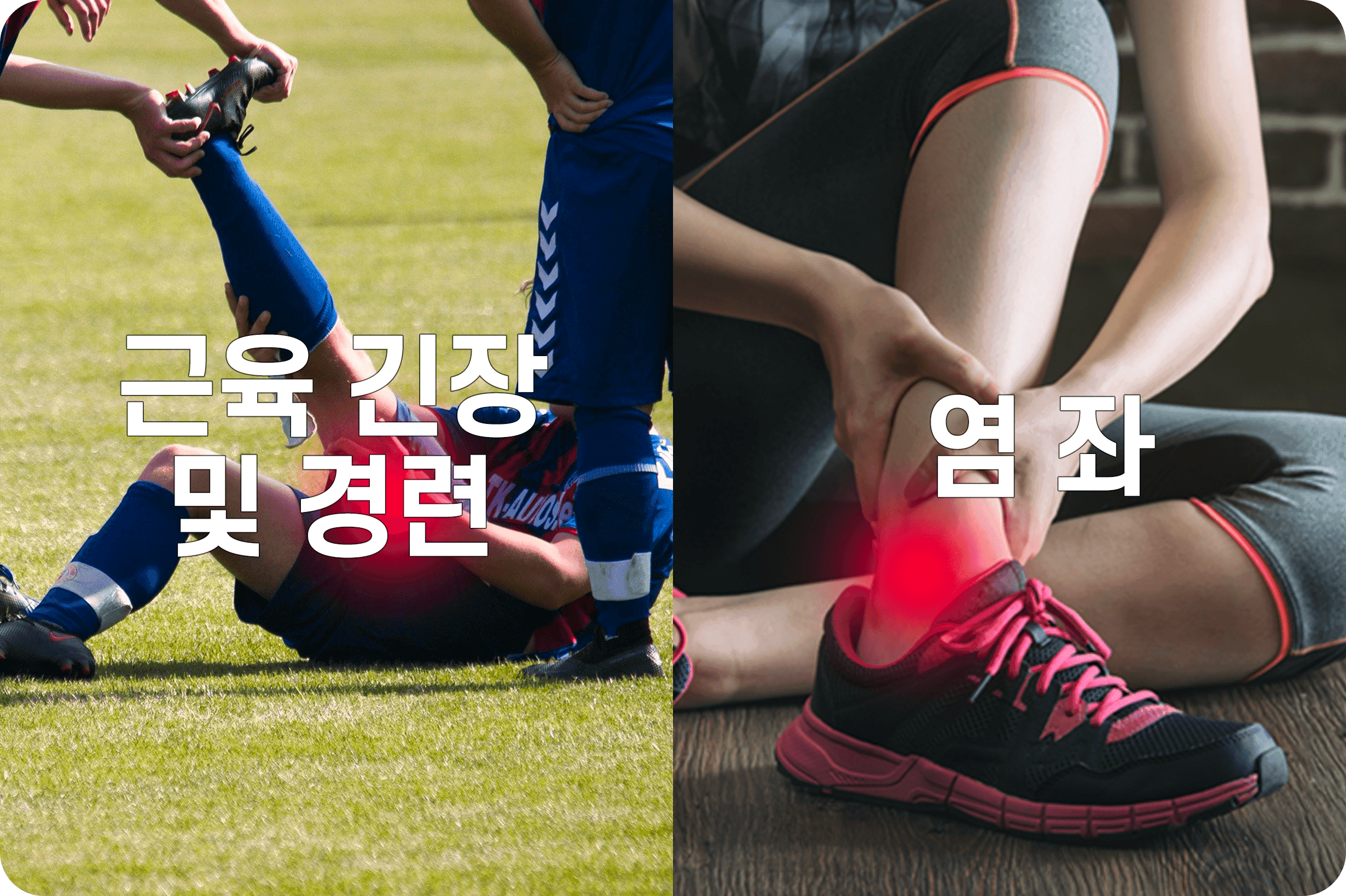 근육 경련, 염좌를 나타내는 사진