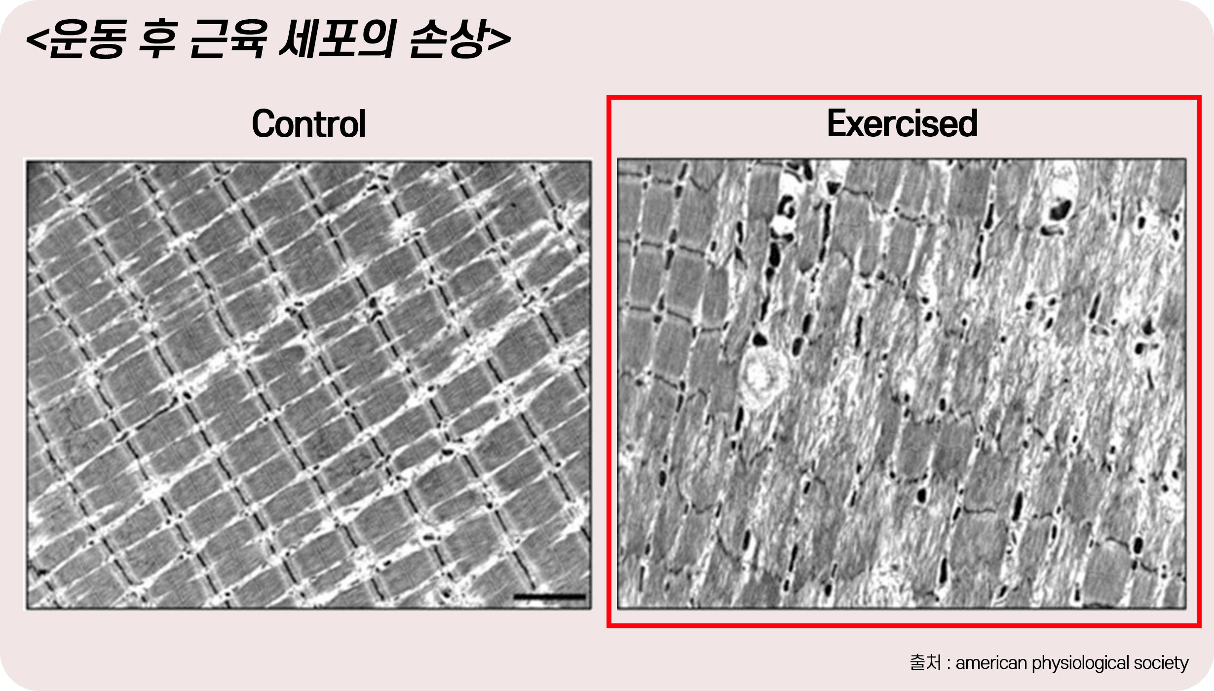 운동후 근육 세포 손상된 모습 비교 사진