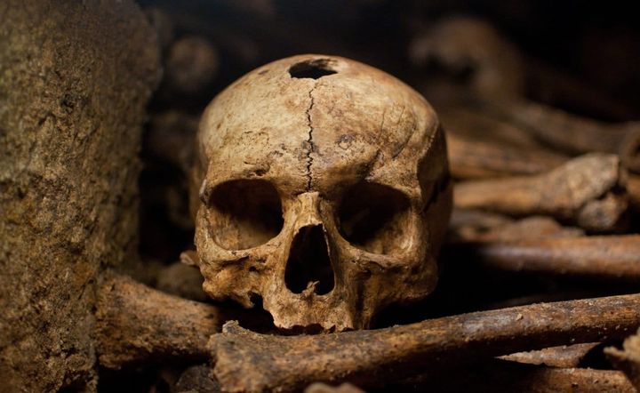 A human skull with a hole in the top of t's head and other bones laying inside the Paris Catacombs.
