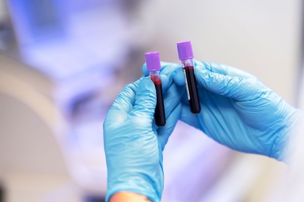 Test genético en el embarazo: ¿Qué es y cómo se realiza?