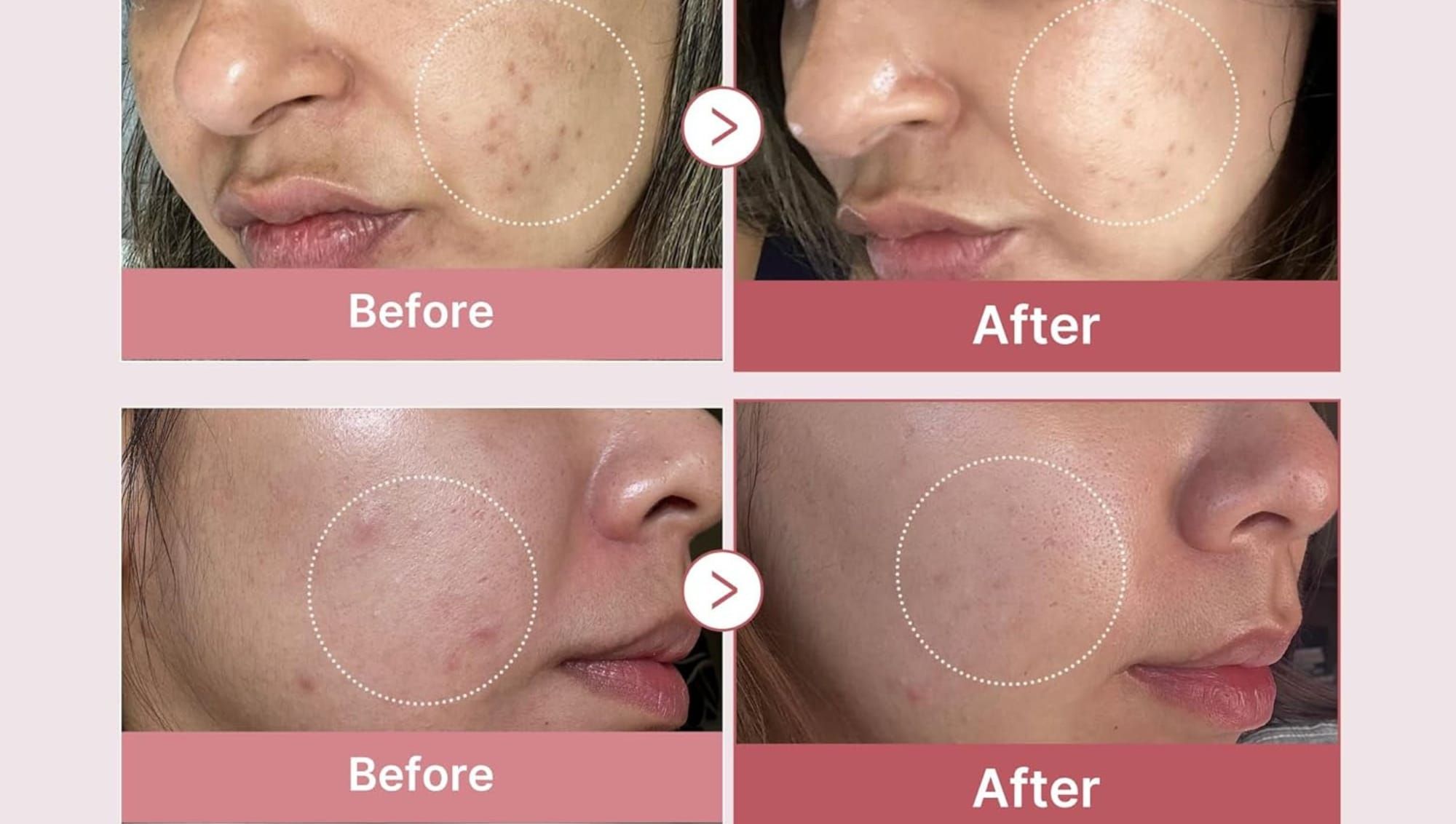 Unlock Radiant Skin: How PDRN Serum Revitalizes and Repairs Your Skin Naturally