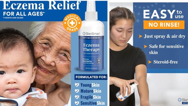 Hypochlorous Acid Spray is a revolutionary skincare solution that is safe and gentle for all skin types!