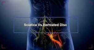 Herniated Disc & Sciatica
