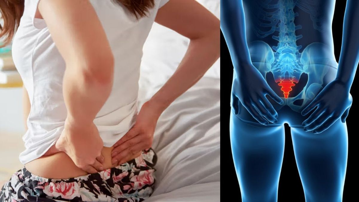 Problems with Coccyx Pain -  Causes, Symptoms & Solutions
