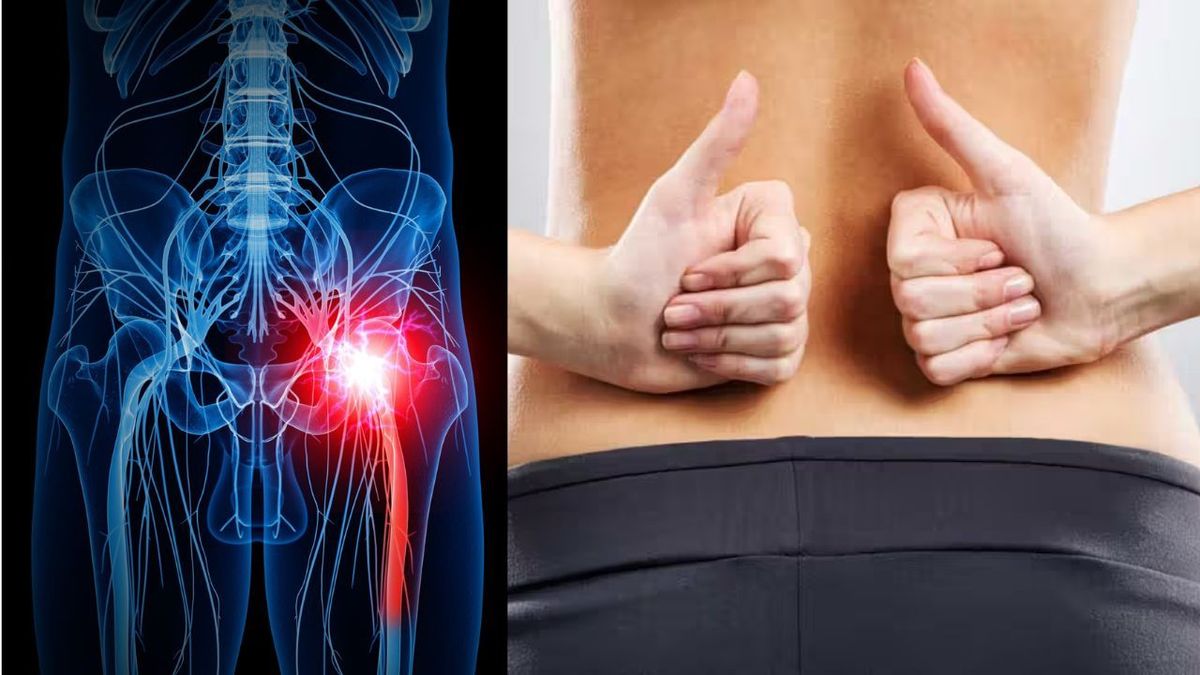 How Do I Get My Sciatic Nerve To Stop Hurting?