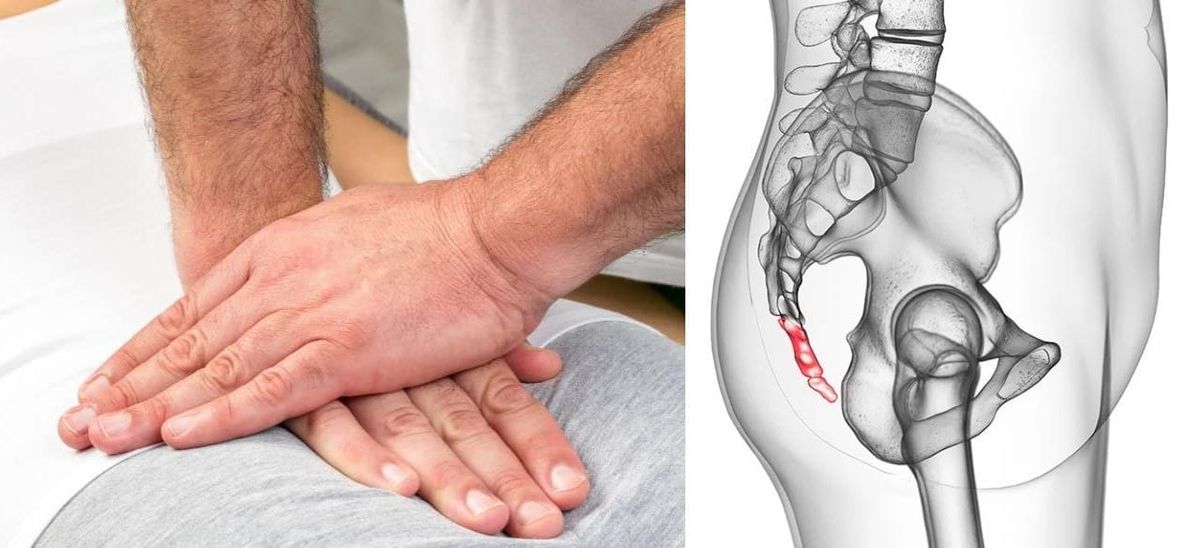 Coccyx Pain with Sciatica: Ways To Find Reliefs