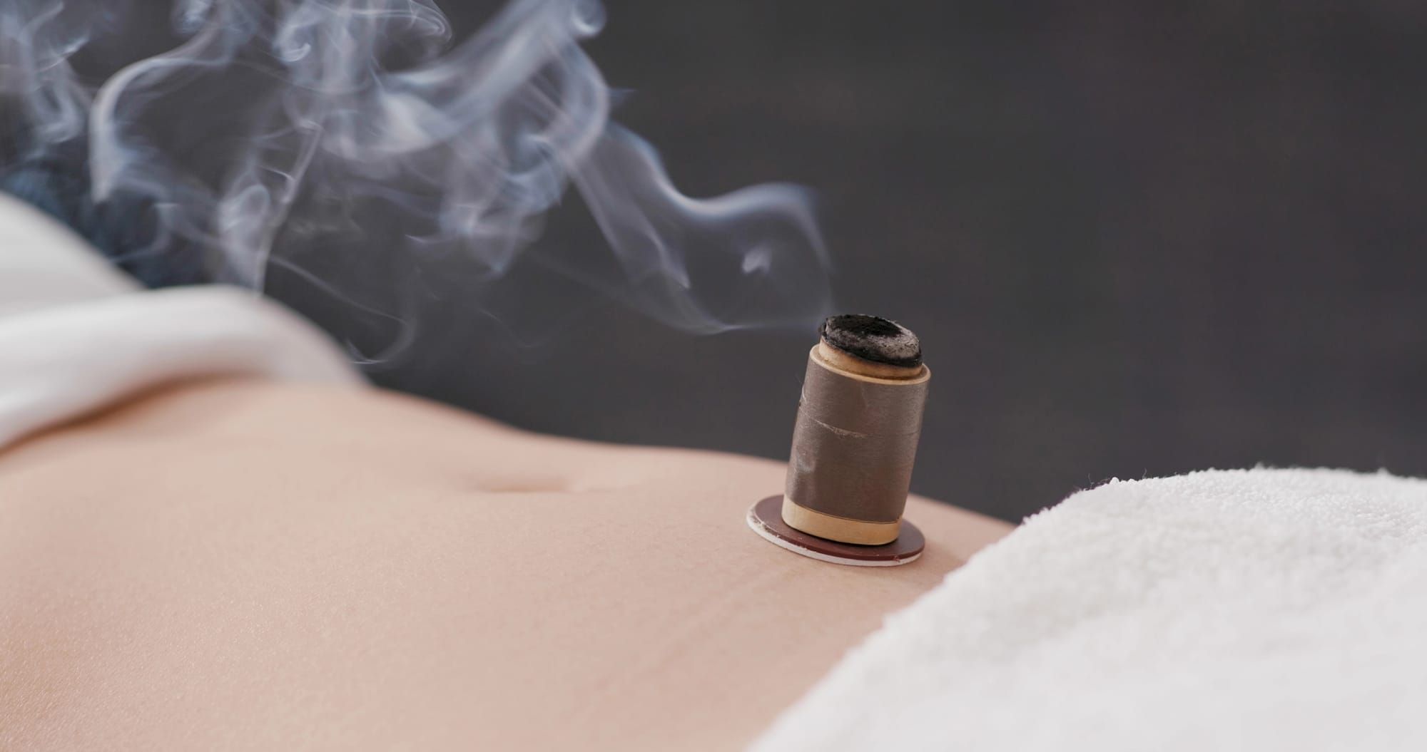 Tsubo and Moxibustion Workshop August 3