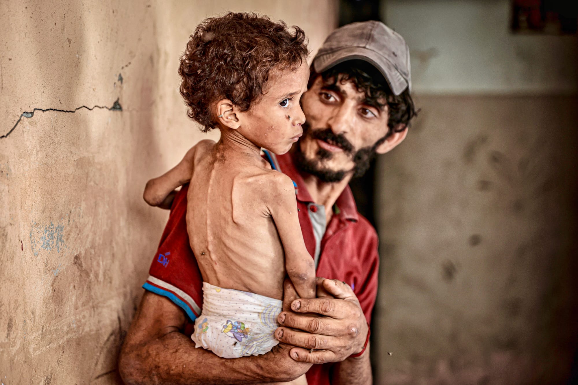 netanyahu food poisoning gaza starvation