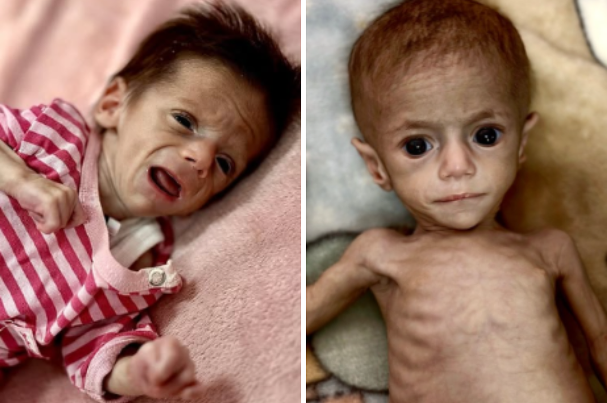 14000 babies gaza dying famine israel blockade