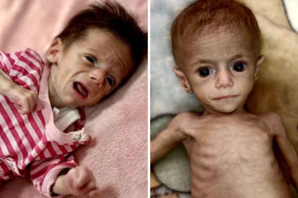 14000 babies gaza dying famine israel blockade