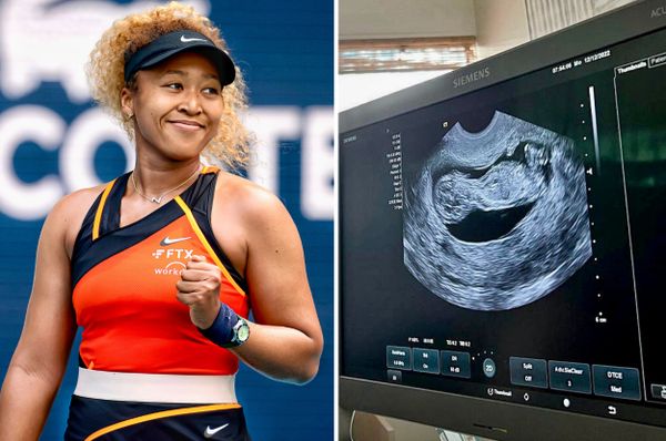 naomi osaka pregnant