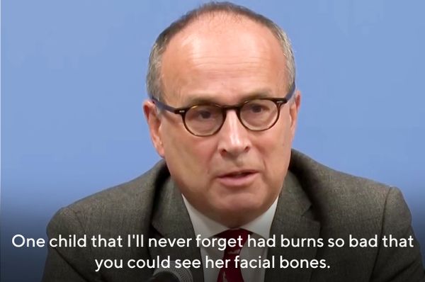 gaza doctor panel un girl burns