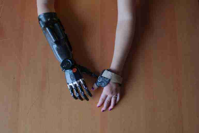 russia margarita gracheva hands compensation