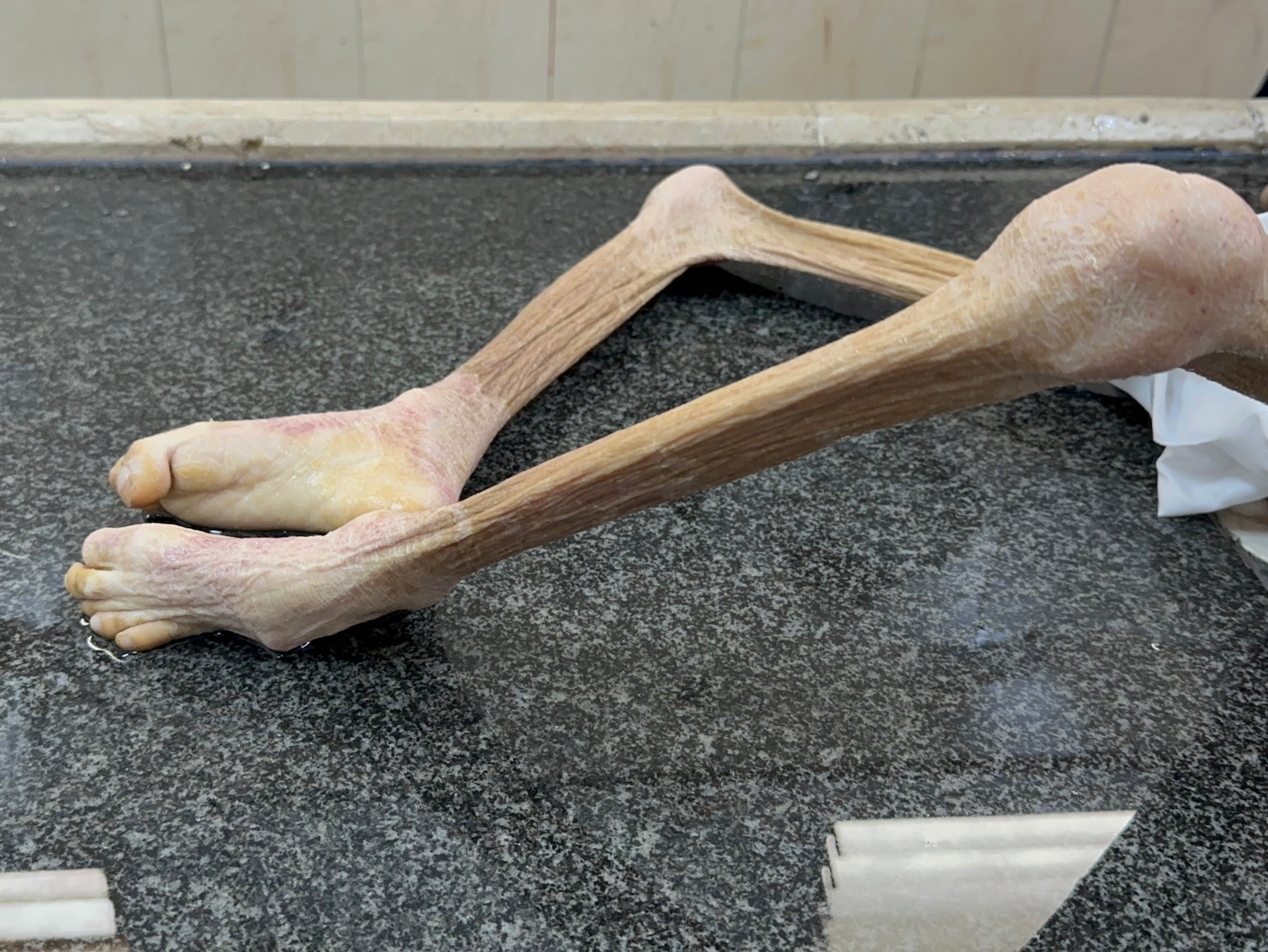 Dead body Palestinian child Yazan al Kafarneh