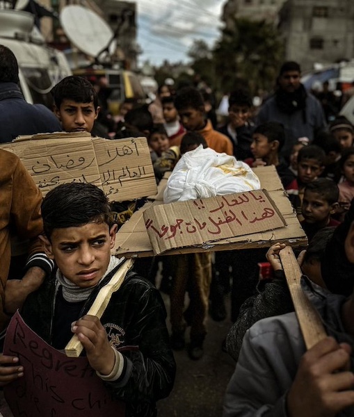 israel attack rafah children malnutrition