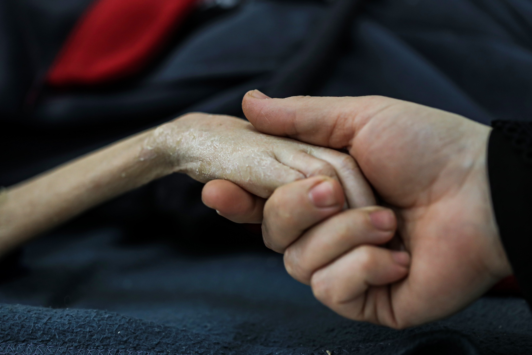 Yezen Al Kfarna suffers malnourishment Israeli blockade