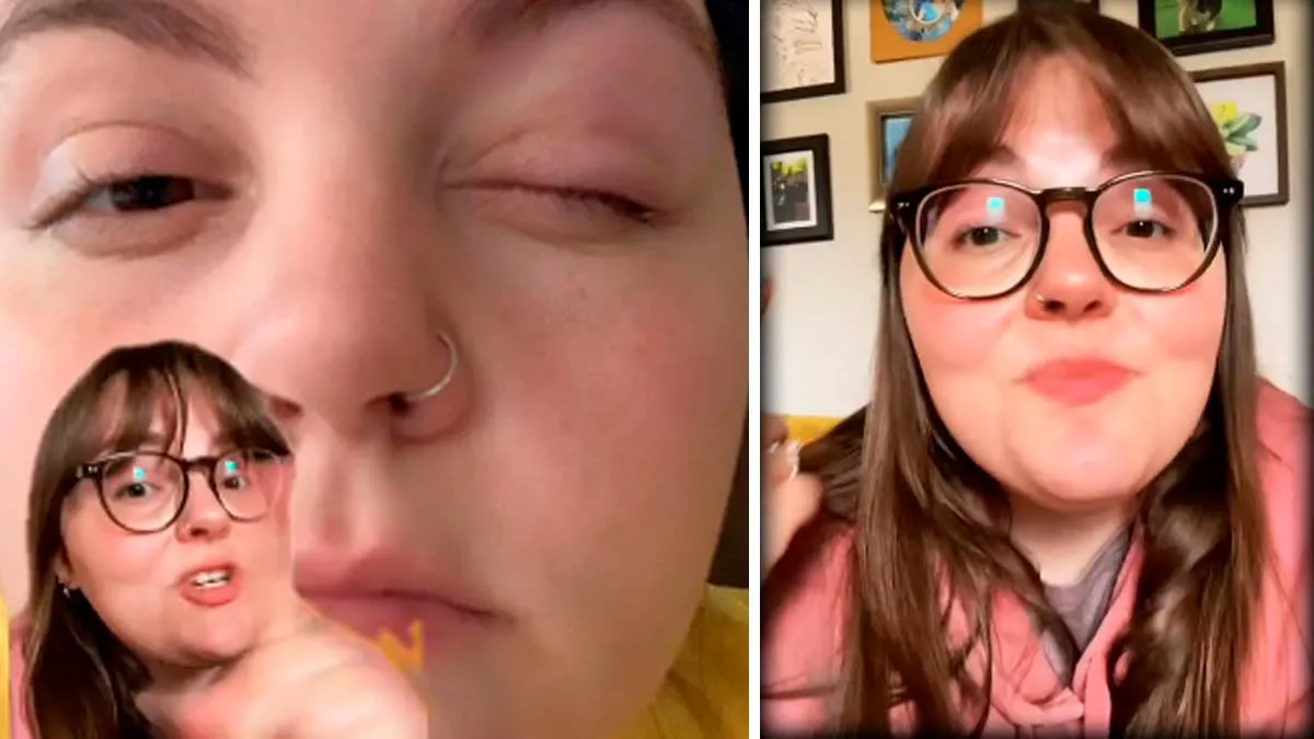 VIDEO | Mujer casi queda ciega por usar lentes de contacto