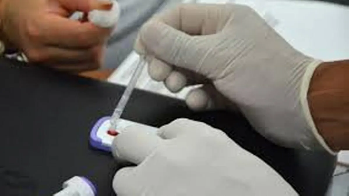 Inician jornadas de pruebas rápidas para detectar VIH en Acapulco