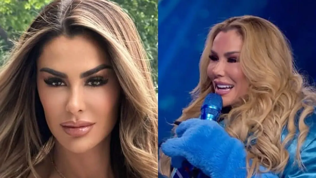 Ninel Conde, la adicción a las cirugías le destrozó el rostro; recibe críticas por usar filtros