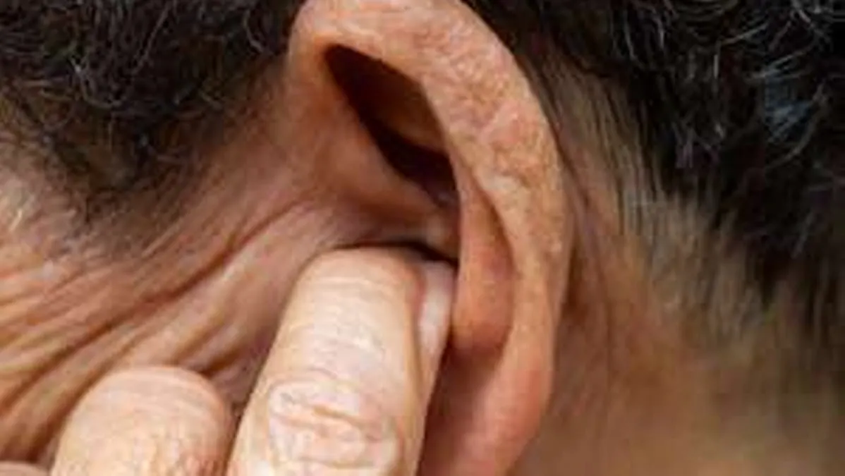 México: entre ocho y 10 millones de personas viven con algún grado de pérdida auditiva. Salud