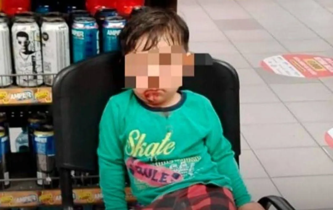 Misterio en Tampico: niño de 3 años aparece solo y herido en un OXXO de madrugada
