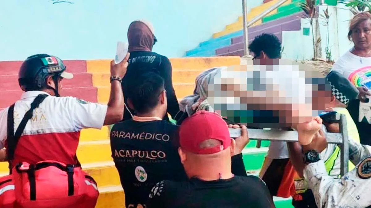Lancha invade zona de bañistas y hiere a una adolescente en Acapulco