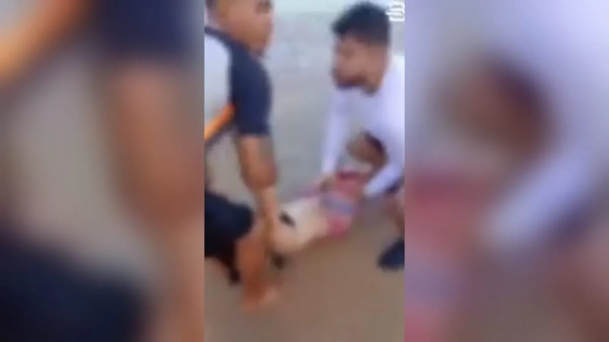 Niño de 11 años y joven de 19 pierden una pierna tras ataques de tiburón en playas de Brasil en menos de 24 h