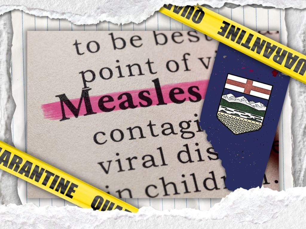 Alberta rolled the dice on “personal choice,” measles won