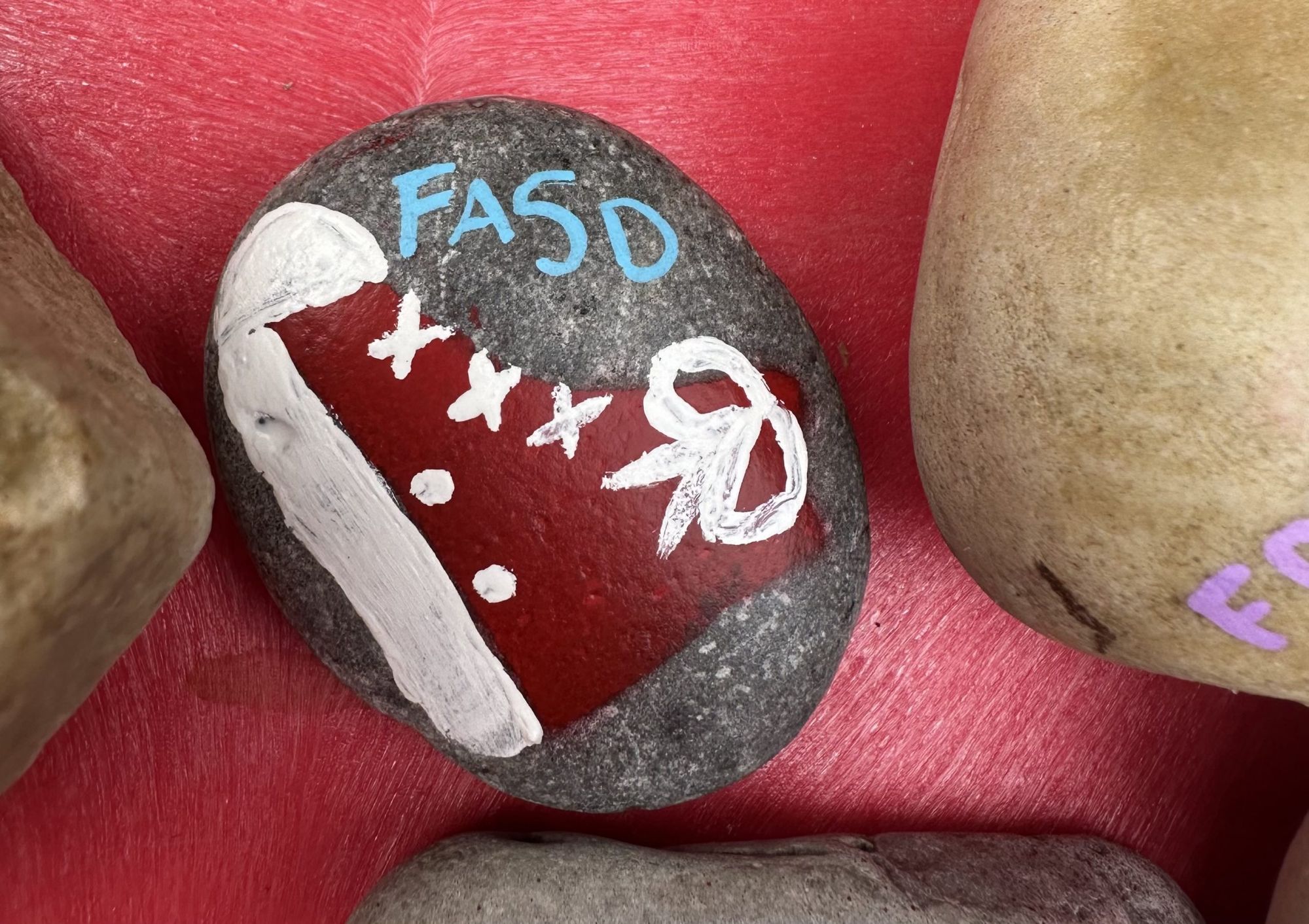 U of C study encourages further understanding and support of FASD