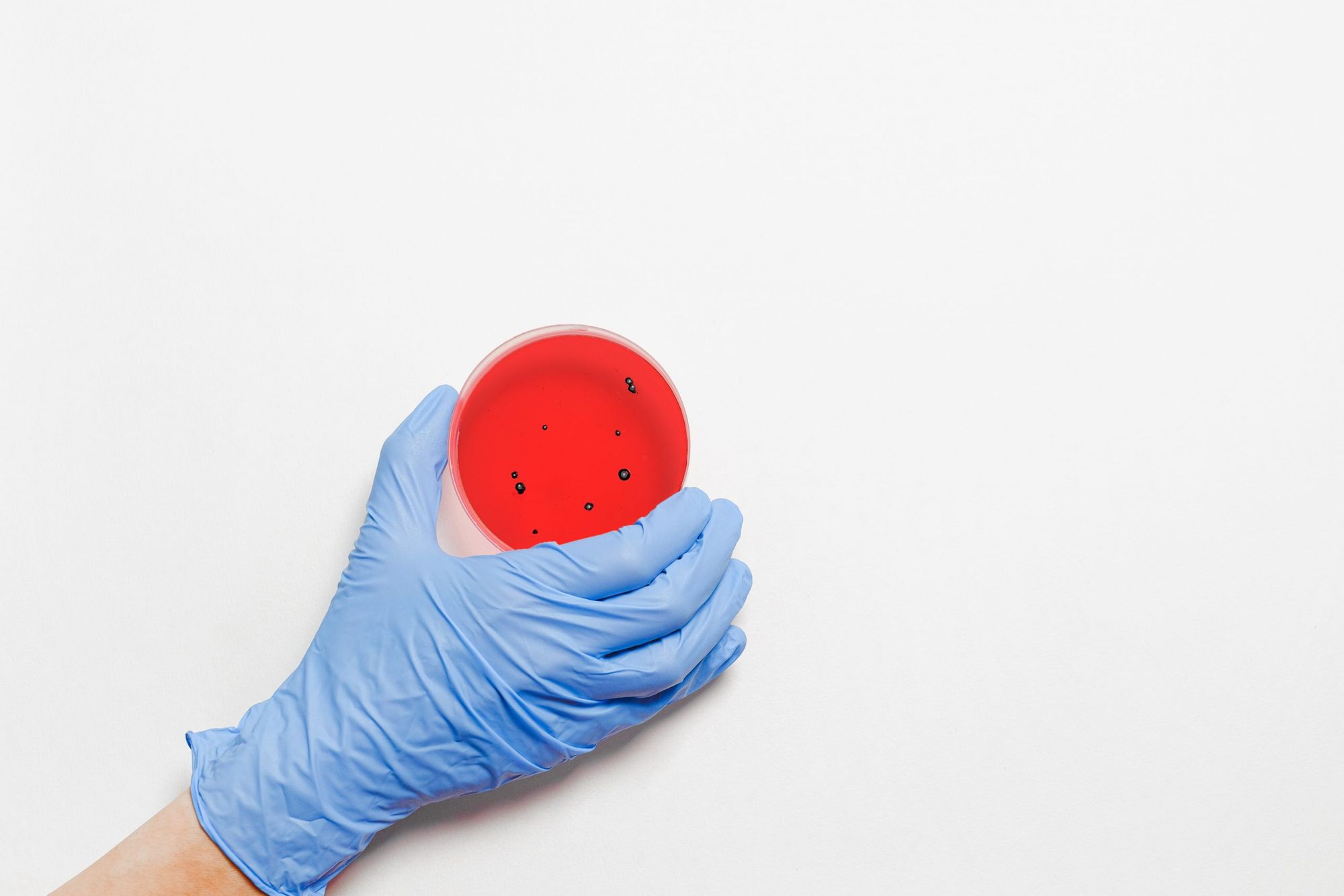 The stigmatization of monkeypox: Did we not learn from the 80s?