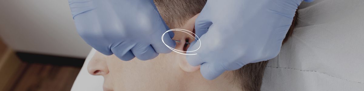 Daith piercing (or "anxiety piercing") location