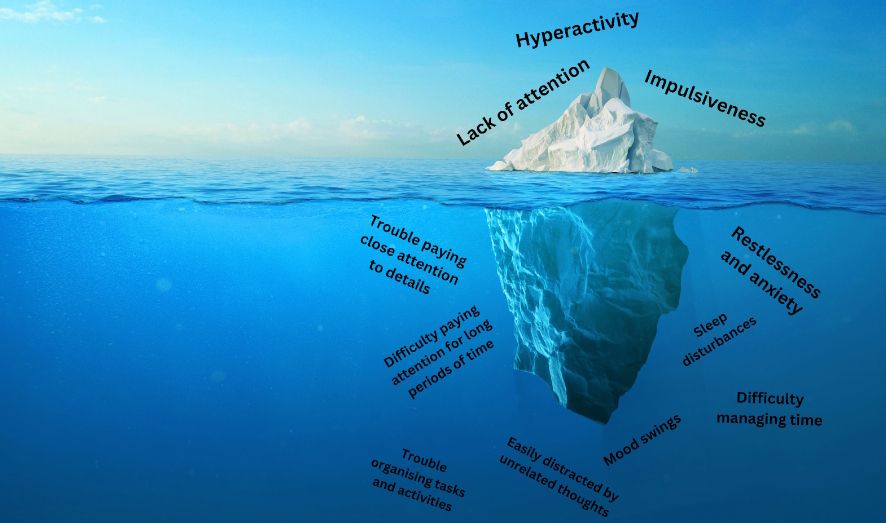 The ADHD iceberg explained