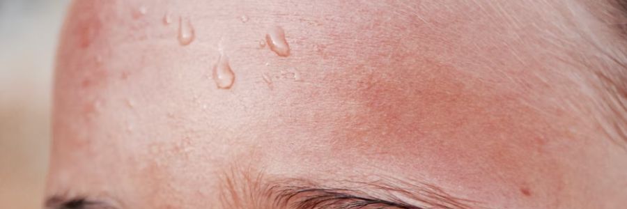 Challenges for autistic people in the heat