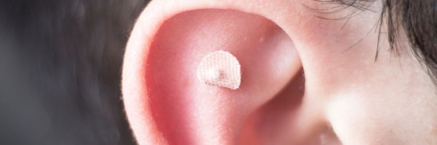 What are ear seeds?