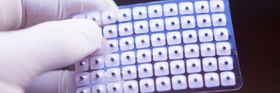 Do ear seeds really work for anxiety?