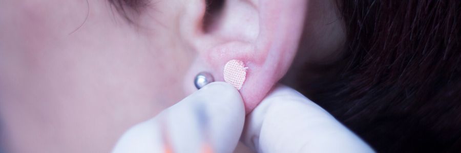 Ear Seeds For Anxiety: Do They Really Work?