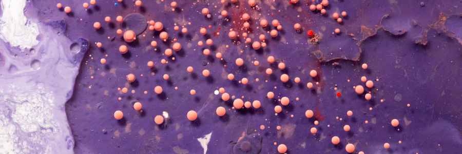 Signs of AuDHD in women and girls