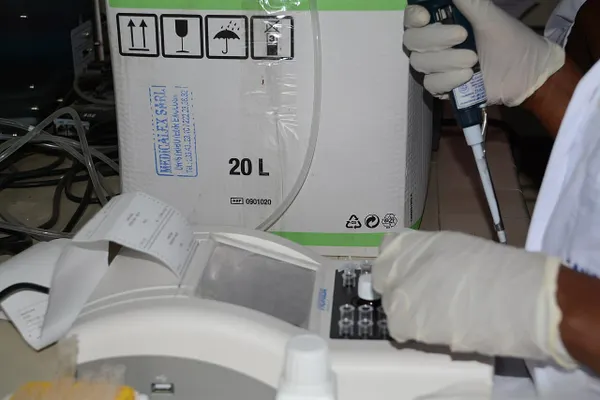 La OMS declara terminado el brote de ébola en Uganda, pero advierte que persiste sin control en RD Congo