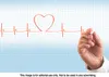 Signs of atrial fibrillation
