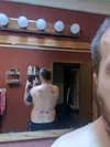 The characteristic red marks are the proof-in-the-clinical-pudding so to speak that it works, say those that administer and those that receive the treatment. Courtesy photo