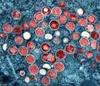 Colorized transmission electron micrograph of monkeypox particles (red) found within an infected cell (blue), cultured in the laboratory. Image captured and color-enhanced at the NIAID Integr
