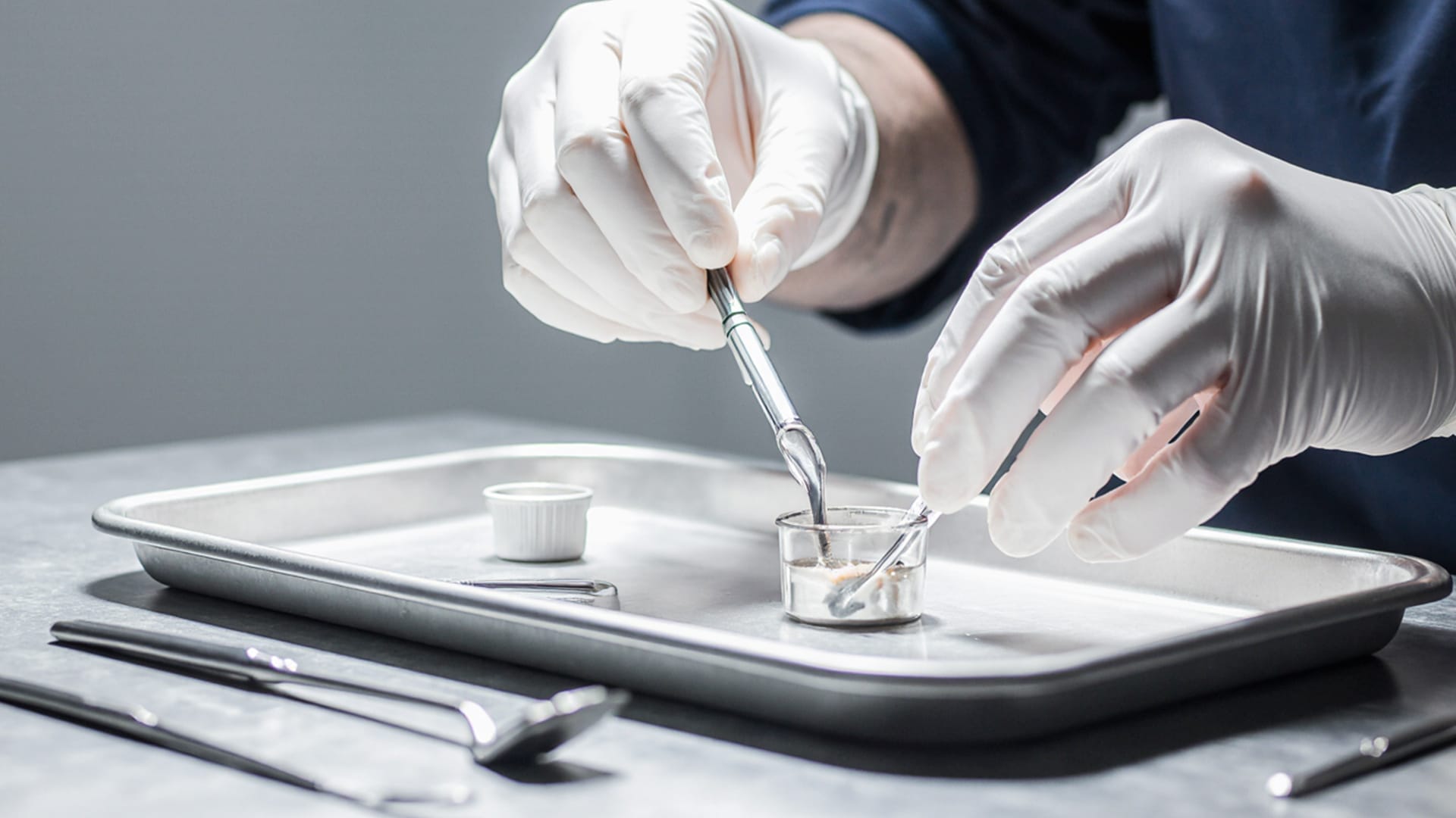 깨끗하고 건강하게 식립된 임플란트 모형이 보이는 치과 진료 환경