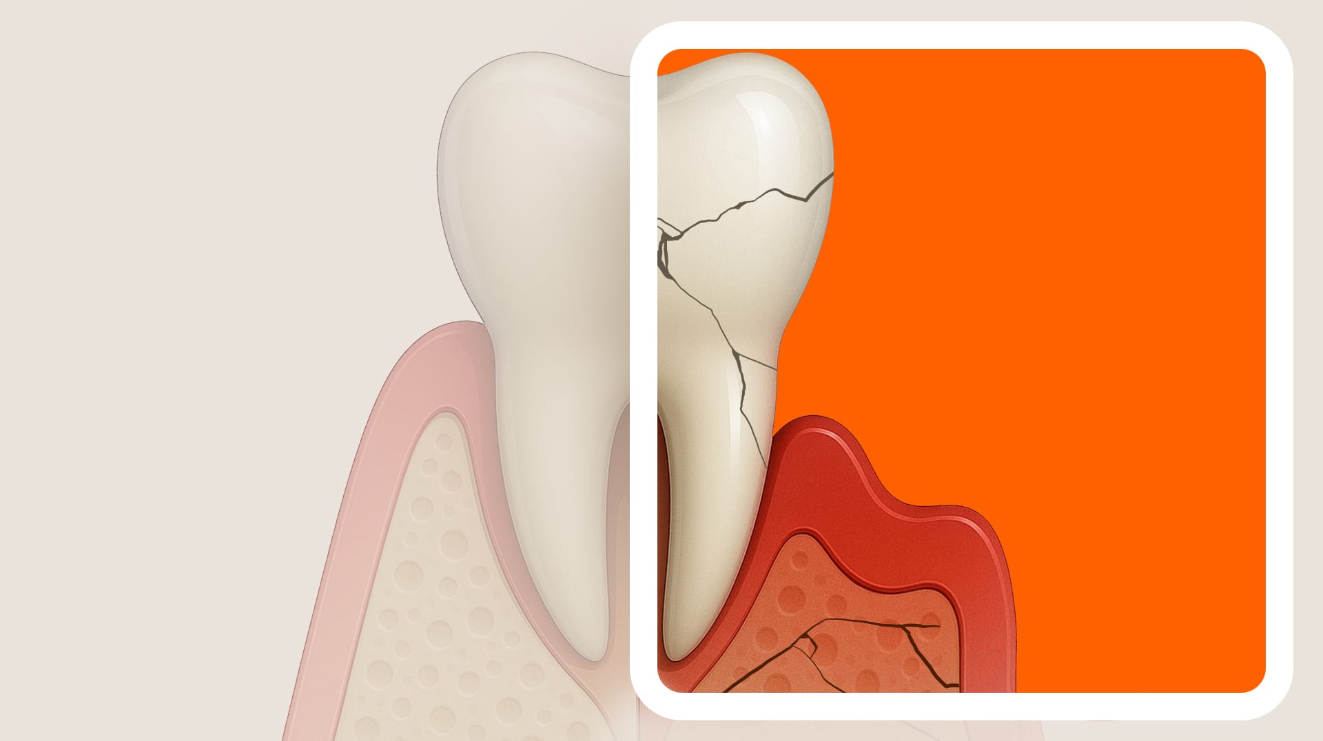 An image comparing a normal jawbone state with a state of insufficient jawbone