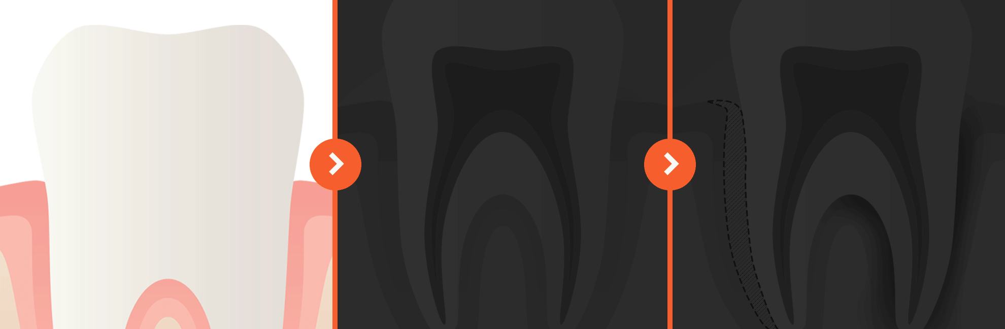 치아교정을 통해 발생하는 내부적 통증, 외부적 통증 이미지