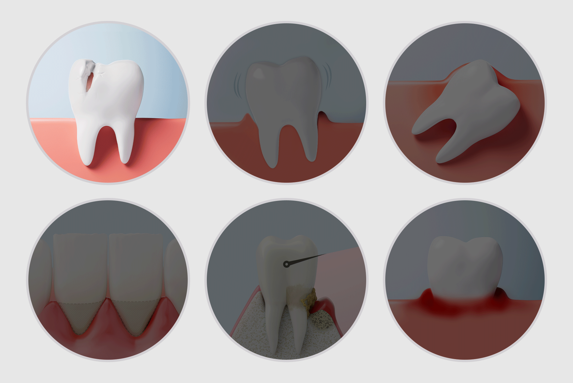 An infographic illustrating typical situations requiring full-mouth dental implants
