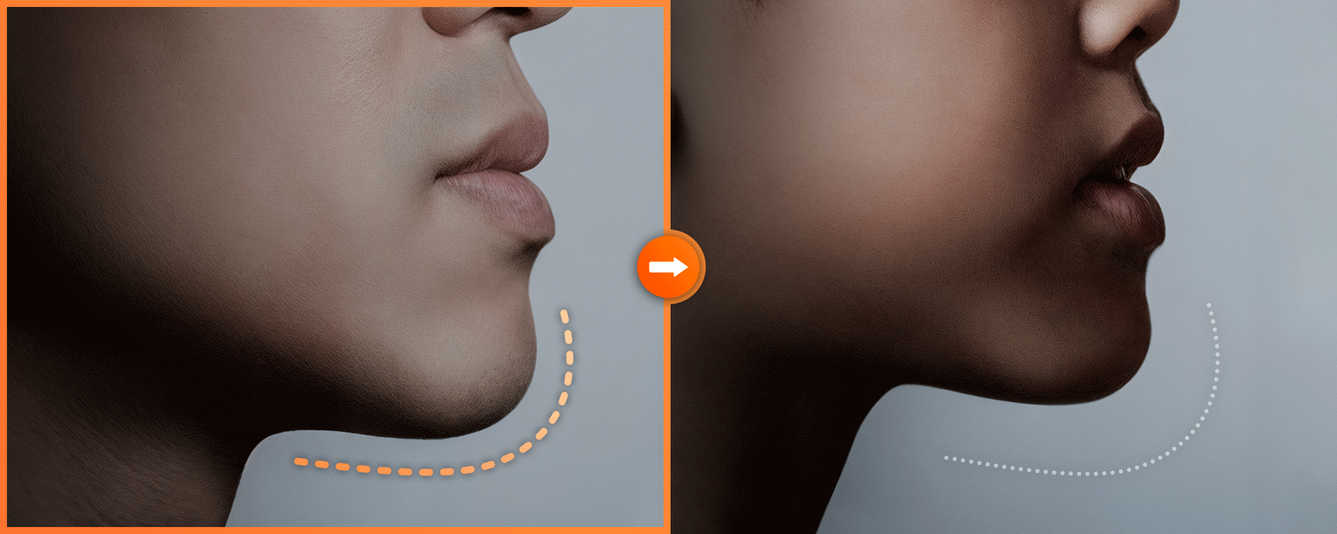 정상적인 턱의 모습과 턱이 돌출되어 있는 모습을 비교한 이미지 