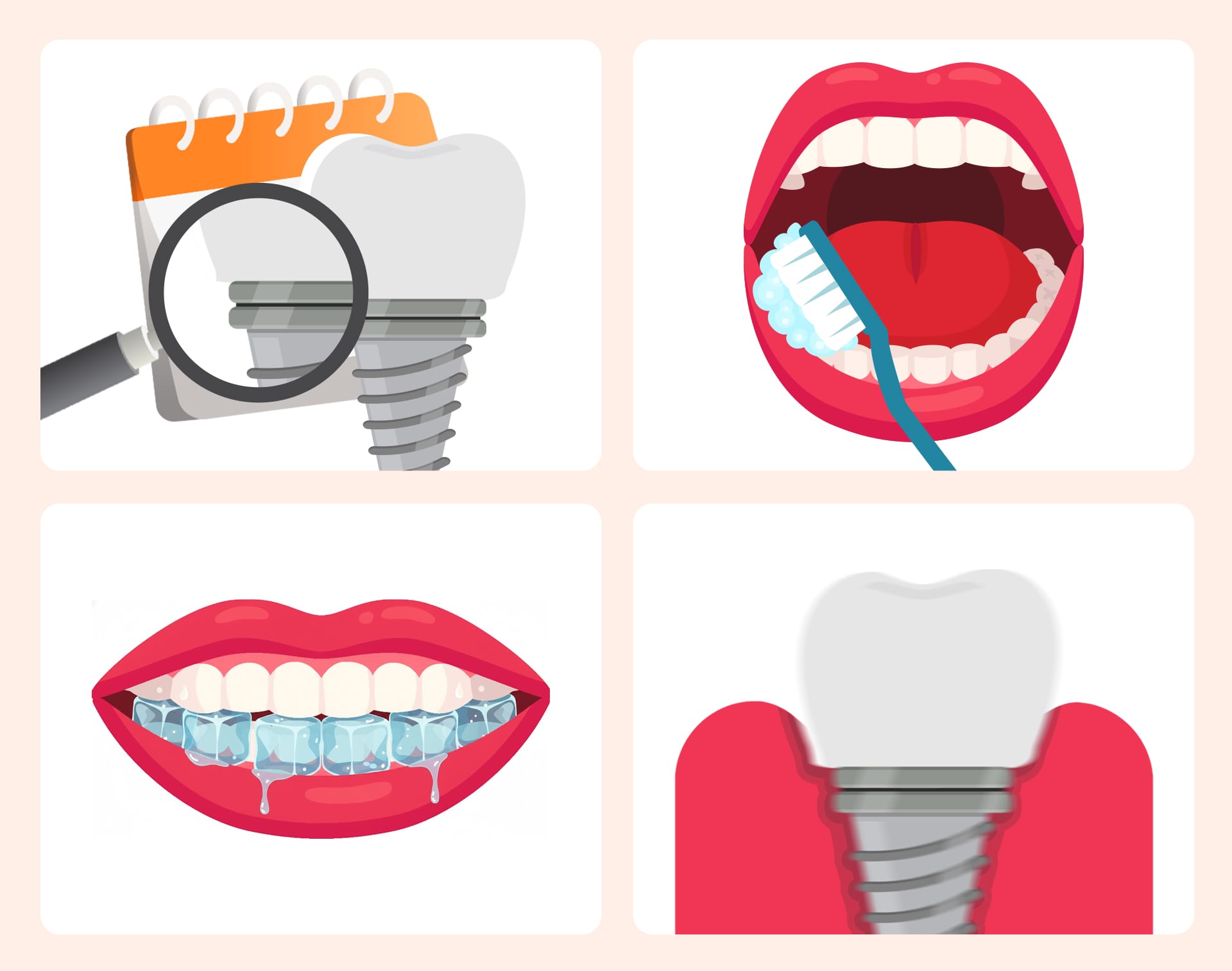 An infographic showing necessary lifestyle habits for maintaining dental implants healthily long-term